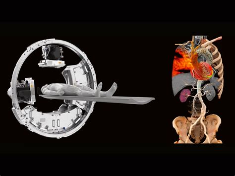 Dual Source CT in cardiac imaging .